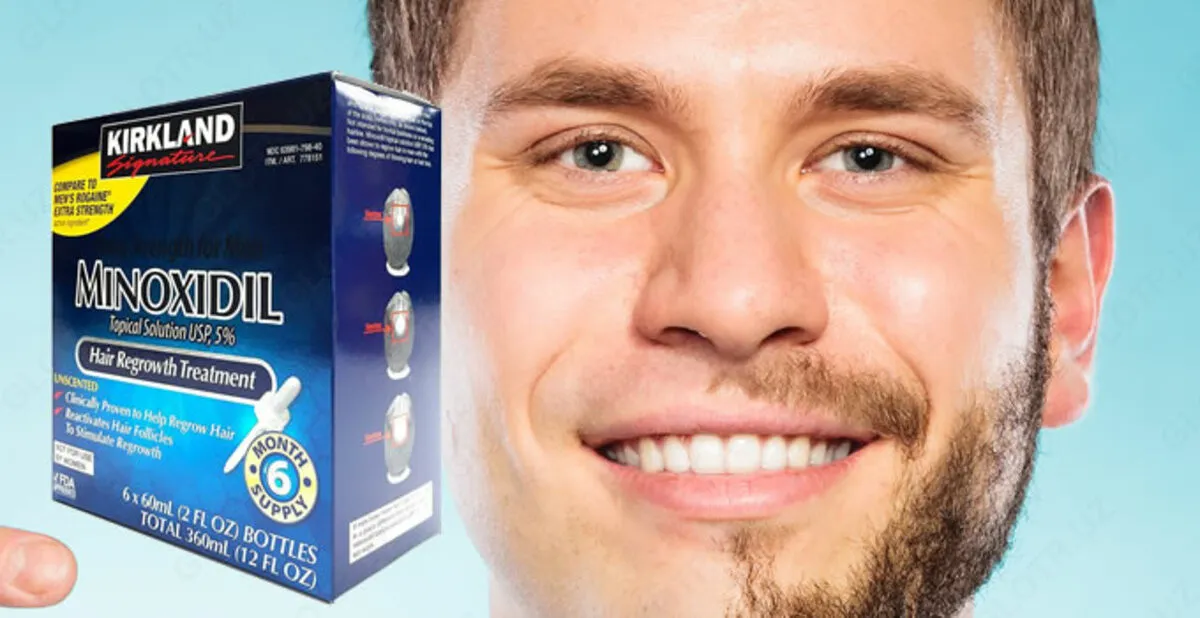 Soch to'kilishi uchun vositalar "Minoxidil Kirkland 5%"#1