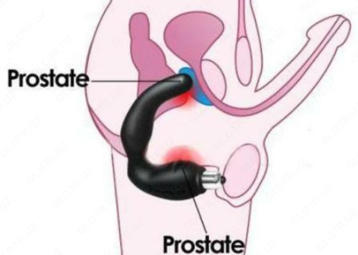 Urologik prostata massajchisi#2