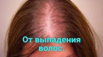 Лосьон для женских волос Миноксидил 10%#3