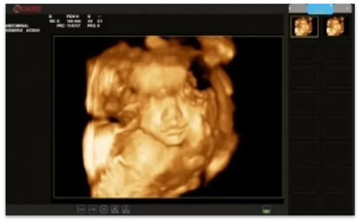 Универсальный портативный ультразвуковой сканер Esaote MyLab Sigma#8