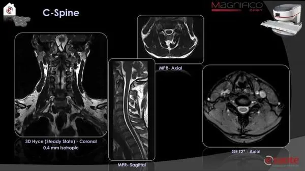 МРТ-система нового поколения с открытым магнитом и напряжением поля в 0.4 Тесла Magnifico#6