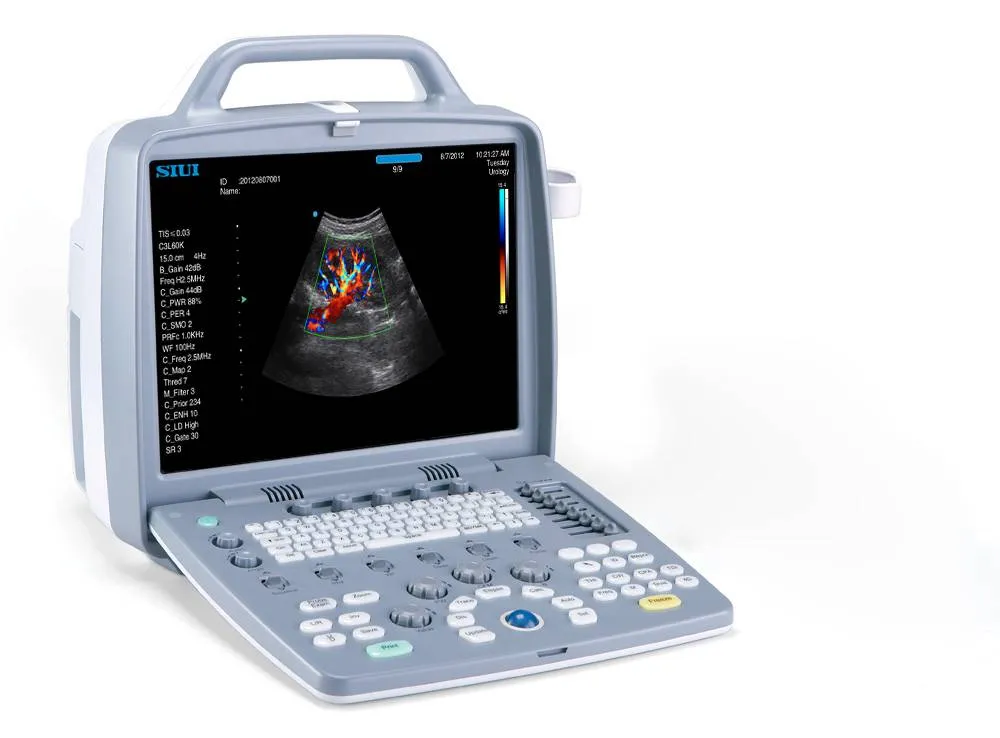 Ультразвуковая диагностическая система CTS-8800#2