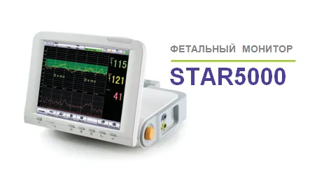 Фетальный монитор STAR5000#1