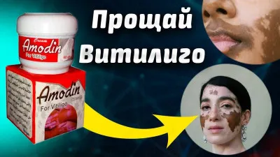 Krem Amodin vitiligo davolash uchun Harraz