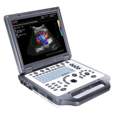 Переносной Ультразвуковой сканер Emperor Medical EMP G30